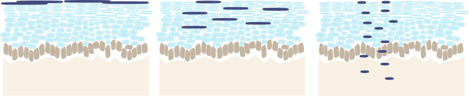 High lenght HA (left), medium lenght HA (middle), short lenght HA (right).